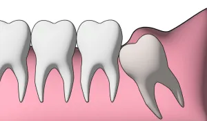 Tooth illustration